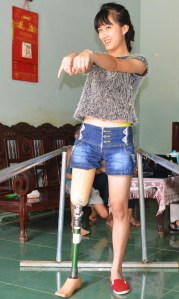 Giữ thăng bằng khi tập đi với chân giả